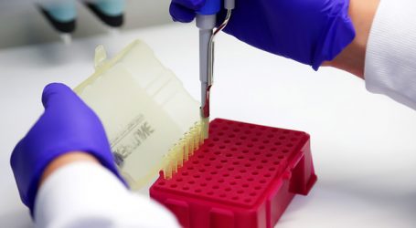 Mañalich informó que llegarán reactivos para PCR destinados a clínicas privadas