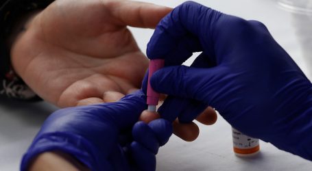 Festival de Olmué: Operativo busca realizar más de 300 test rápido de VIH