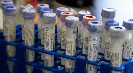Seremi de Salud confirma 6.265 casos de Coronavirus en el Maule