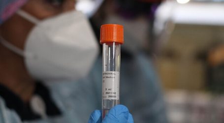 Ministerio de Salud reportó 1.567 casos nuevos de Covid-19 en el país