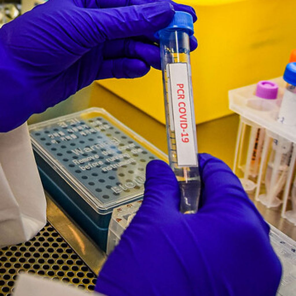 Covid-19: Noruega, Jordania y Canadá confirman presencia de cepa británica