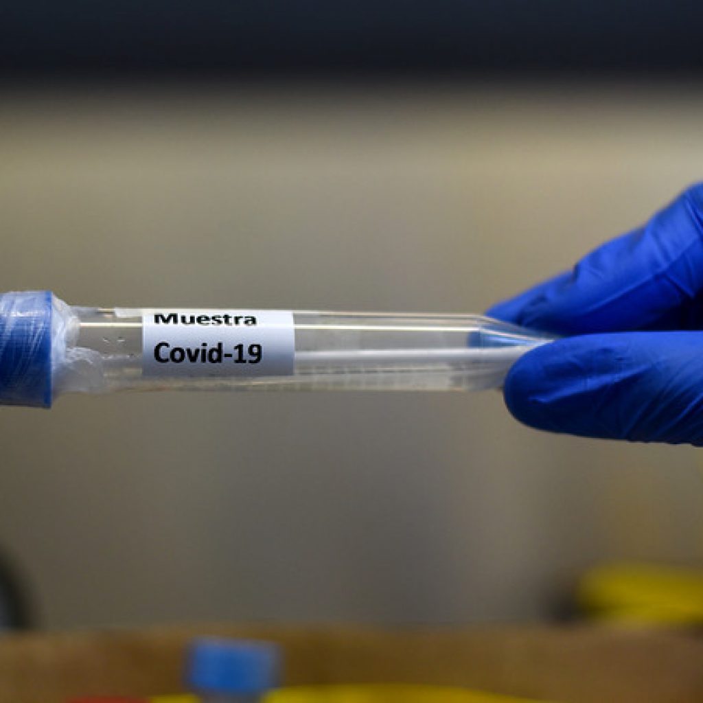 Covid-19: Biobío presenta 507 casos nuevos, 47.898 acumulados y 2.643 activos