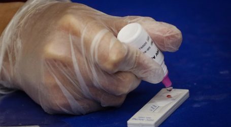 Arica implementó test rápido de VIH para usuarios del Hospital Regional