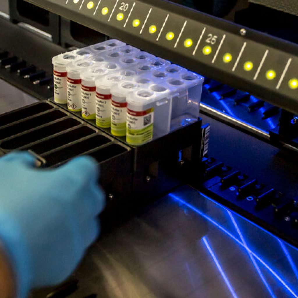 Rusia identifica el primer caso de gripe aviar H5N8 en un ser humano