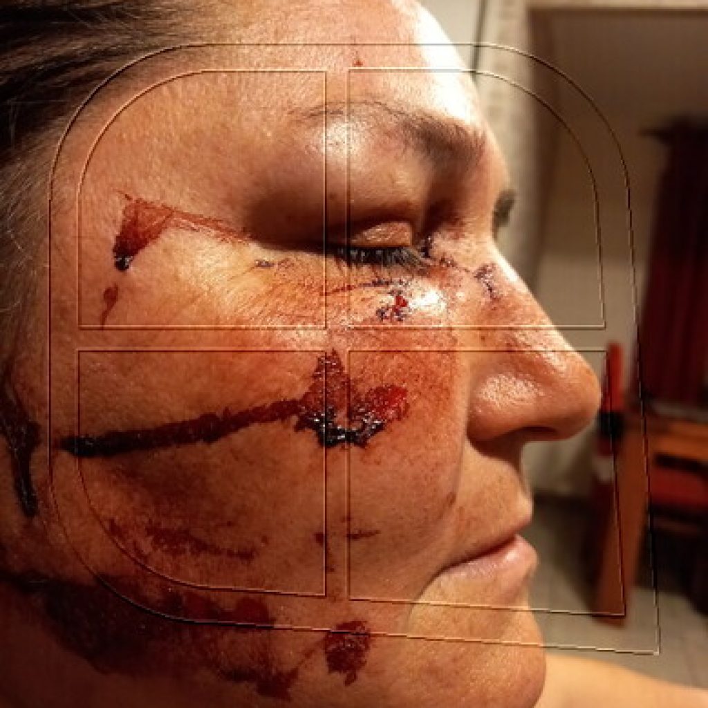 Presentan querella tras ataque a mujer en la comuna de Lampa