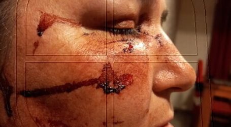 Presentan querella tras ataque a mujer en la comuna de Lampa
