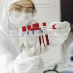 La Lazio y su presidente reciben castigos por incumplir protocolo de coronavirus