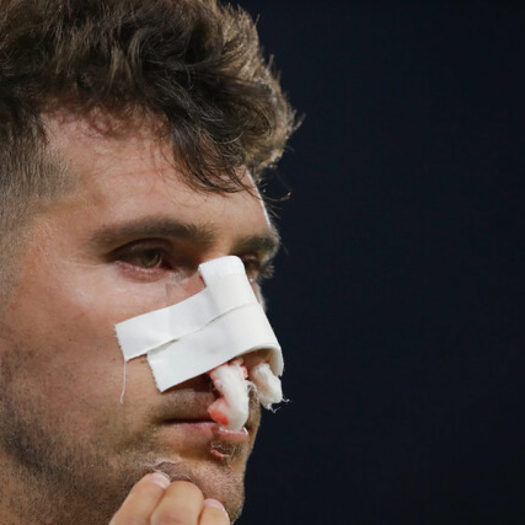 Colo Colo confirma bajas de Campos y Fuentes para duelo con Cobresal