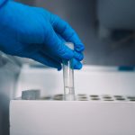Minsal informa que 6 móviles de test de antígenos se usarán en RM