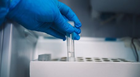 Minsal informa que 6 móviles de test de antígenos se usarán en RM