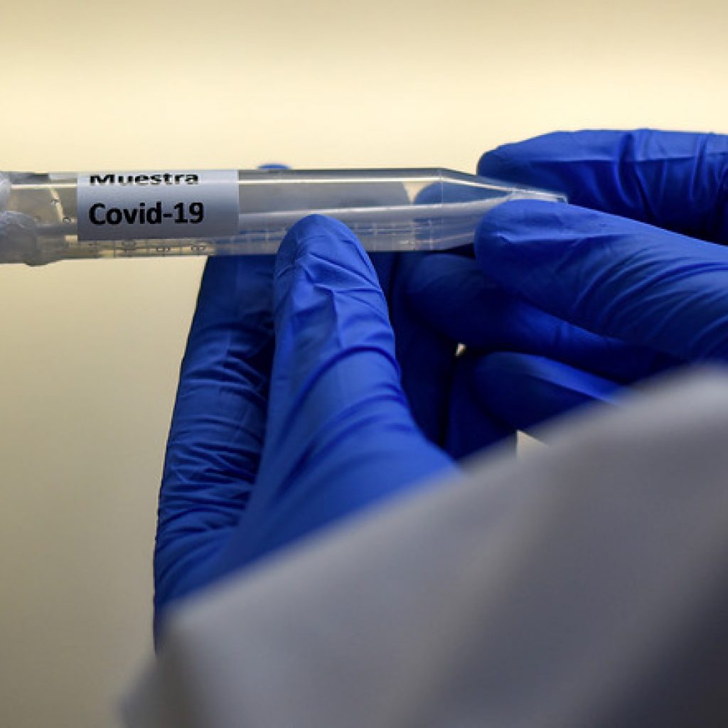 China notifica más de 75 casos de coronavirus por primera vez desde enero