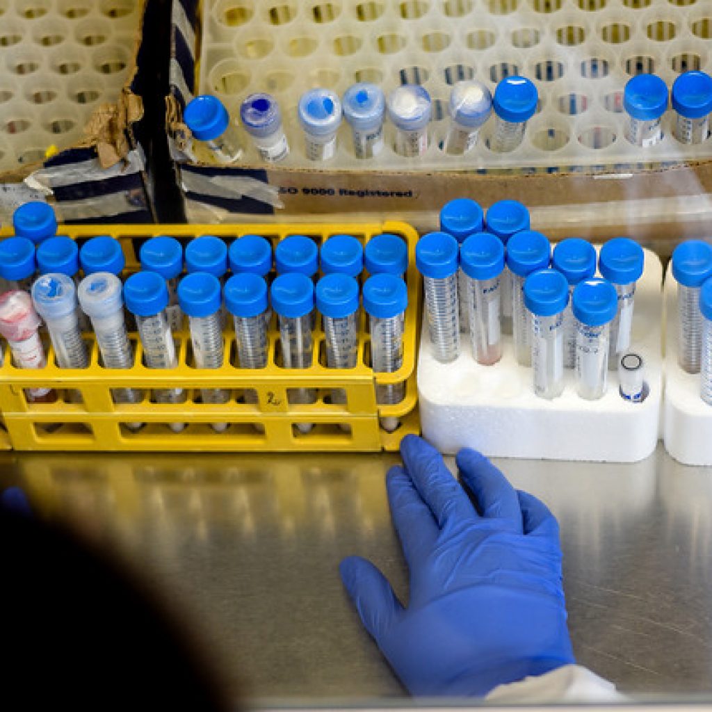 Covid-19: Biobío presenta 87 casos nuevos, 149.112 acumulados y 563 activos
