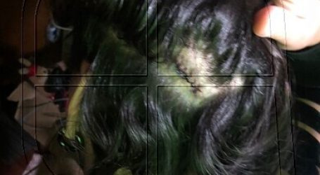 Movilh denunció ataque a mujer trans en la comuna de Buin