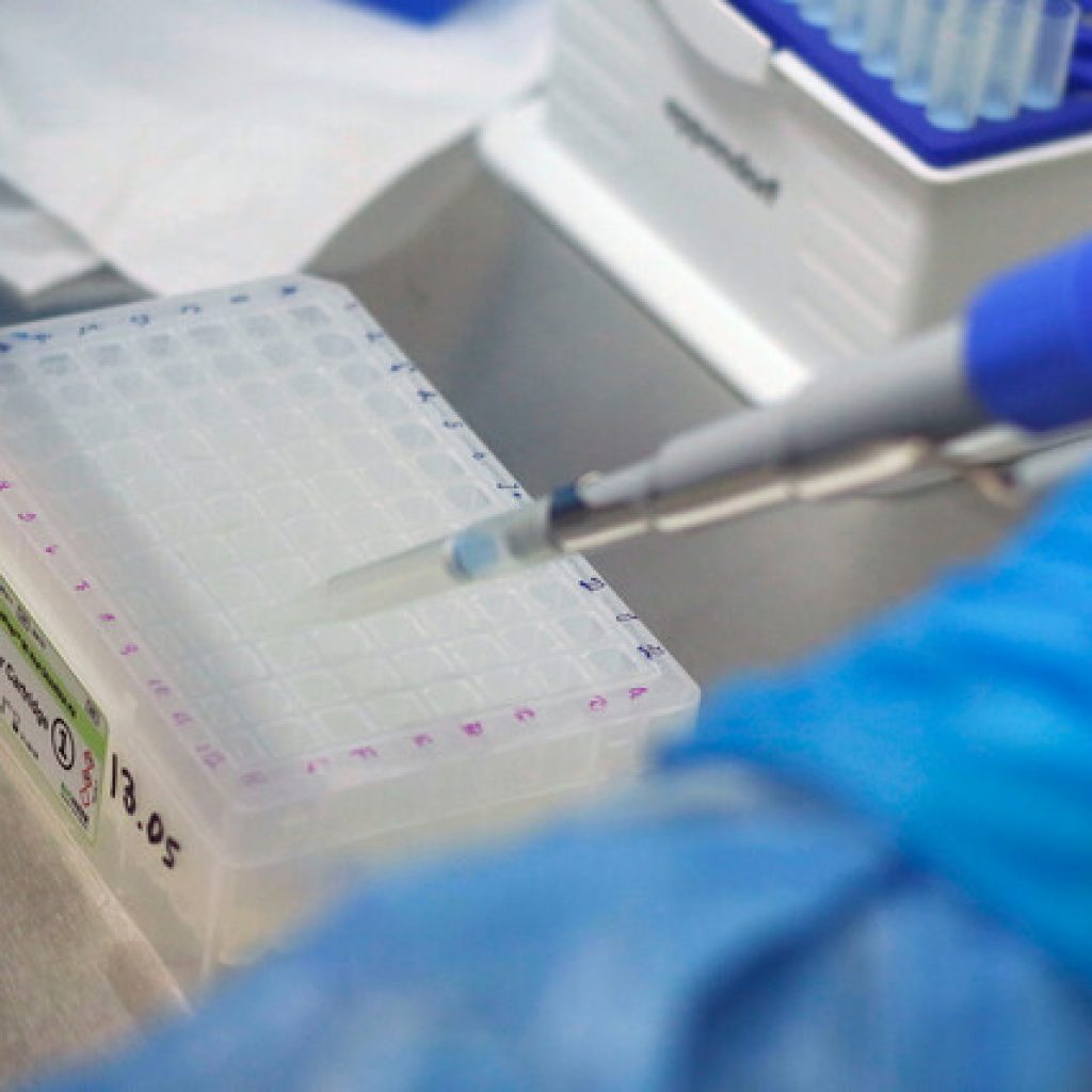 ICOVID Chile: Llaman a intensificar la estrategia de testeo y trazabilidad