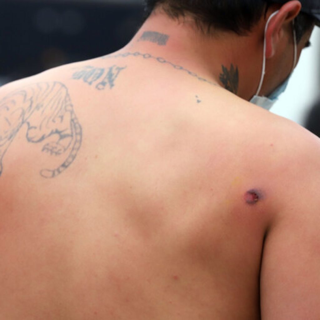 Tres pescadores resultan heridos en medio de protestas en Valparaíso