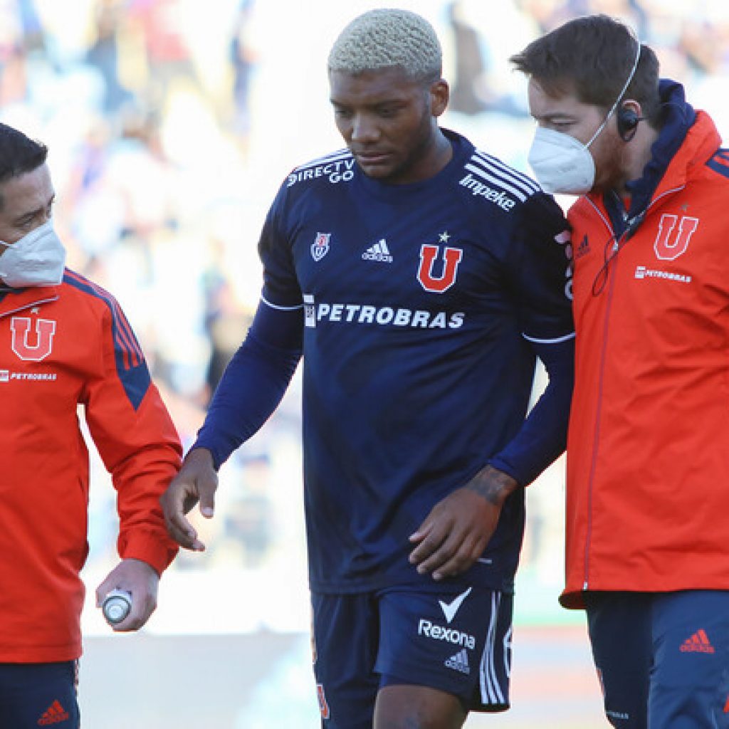 Junior Fernandes es la gran duda de la 'U' para la visita a Cobresal