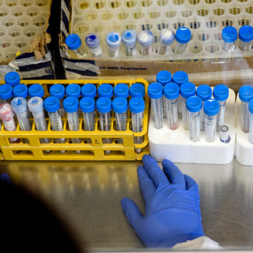 Israel detecta el primer caso de "flurona", una infección de coronavirus y gripe