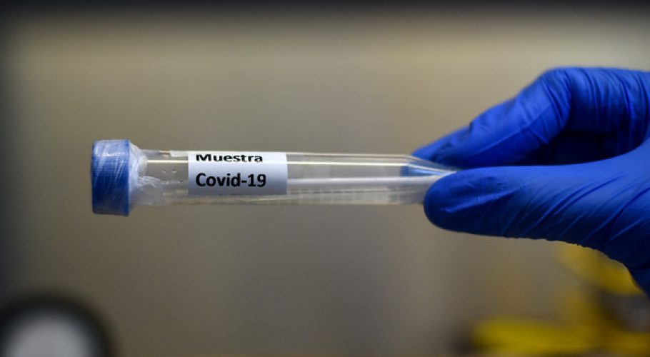 Covid-19: Japón registra cifra más alta de contagios diarios desde septiembre