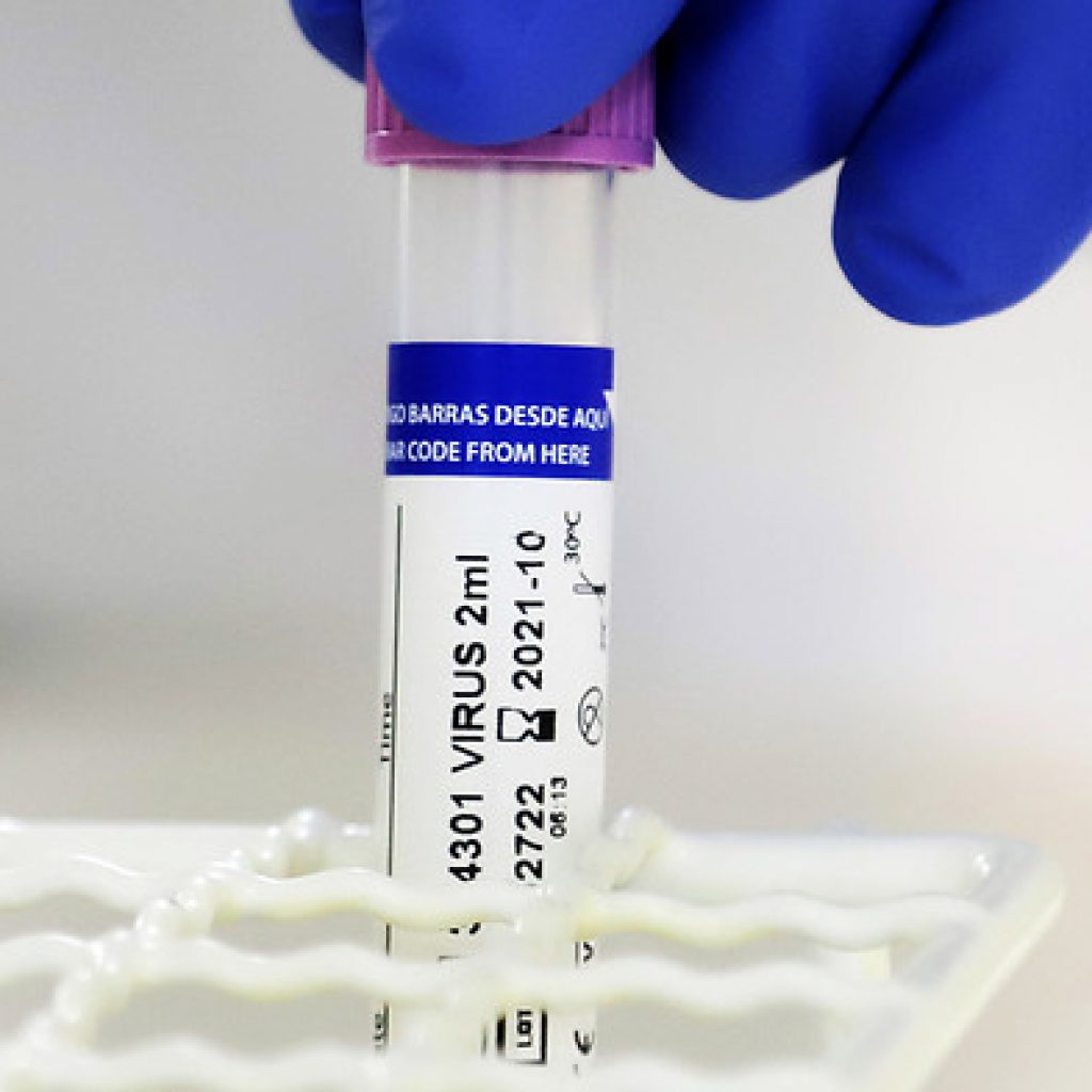 India supera los 37 millones contagios de coronavirus