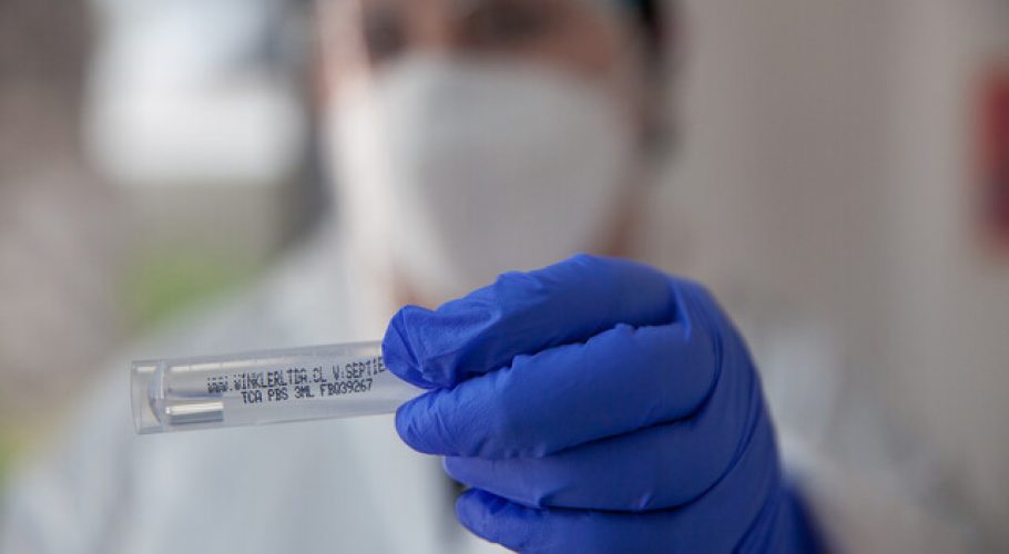 Bolivia registra nuevo récord diario de casos a causa del coronavirus