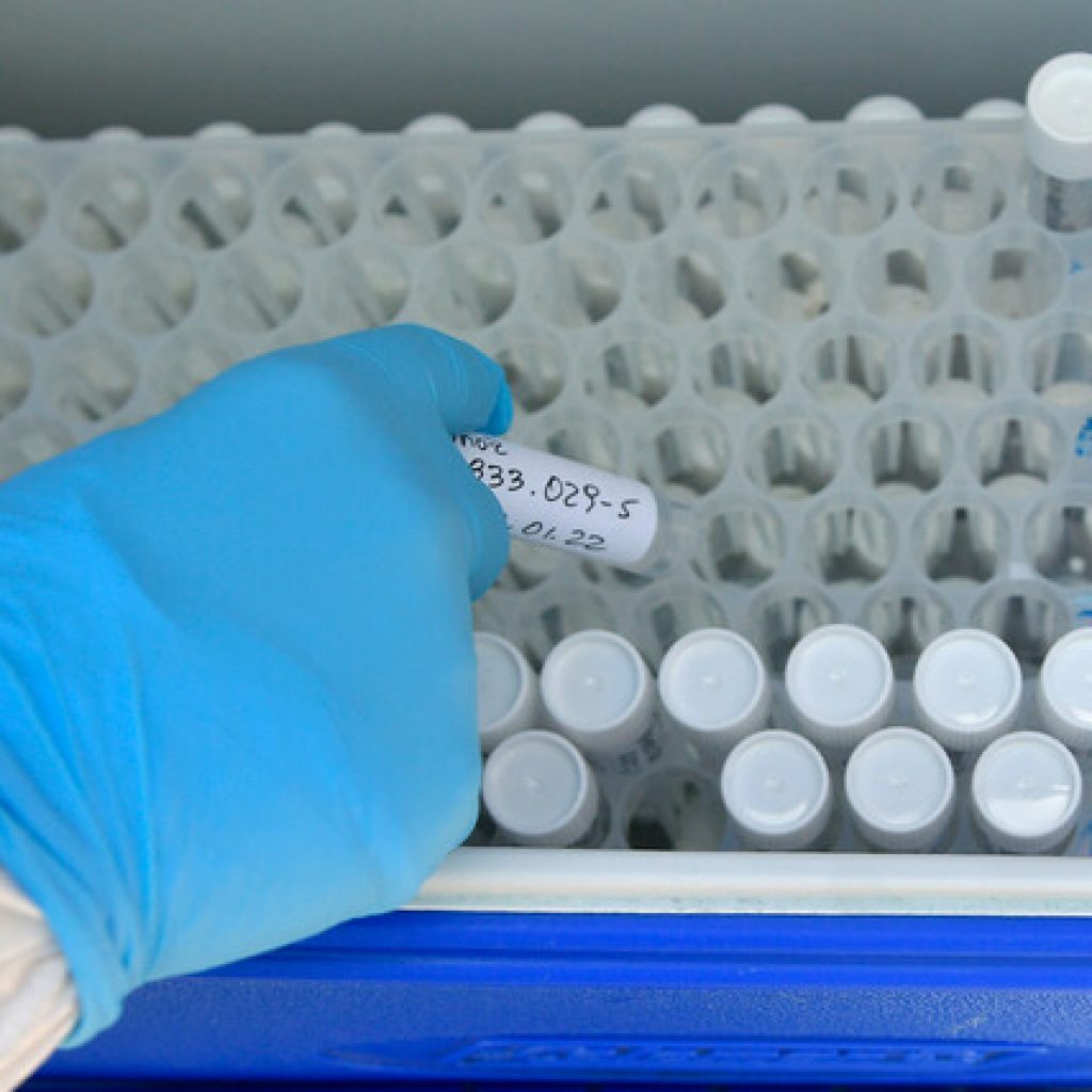 Ministerio de Salud reportó 8.904 nuevos casos de coronavirus en Chile