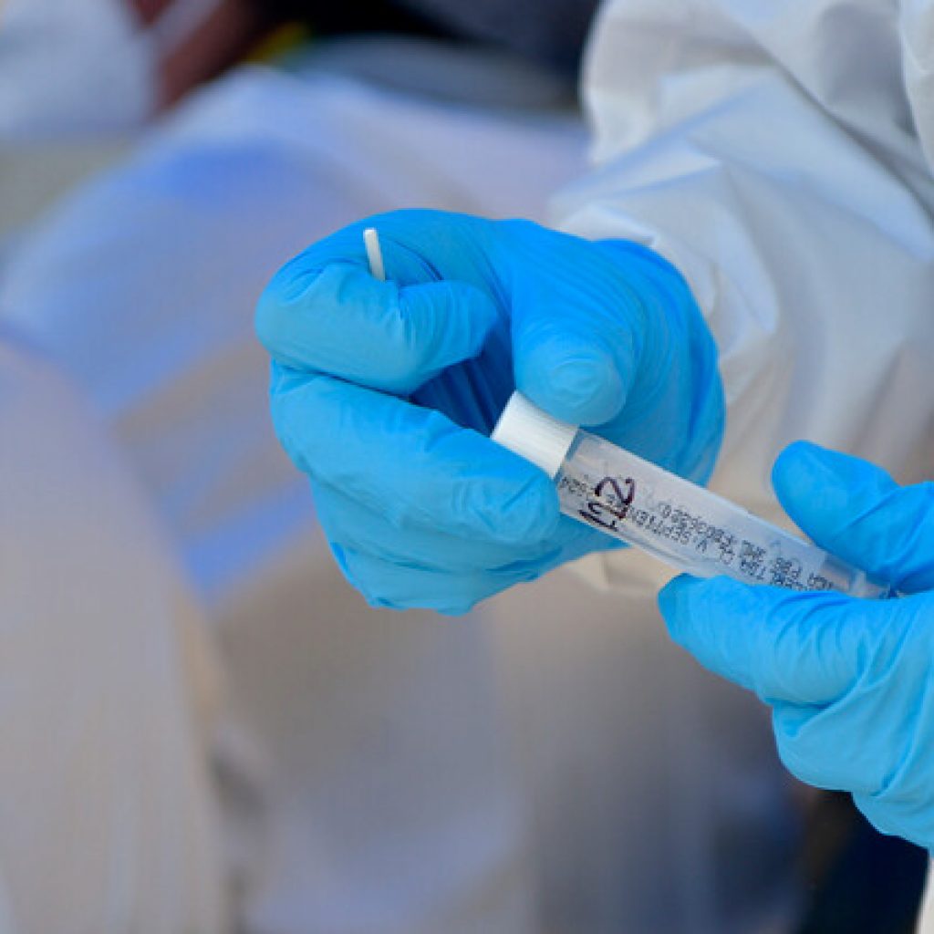 Brasil reduce el número de contagios diarios de COVID-19