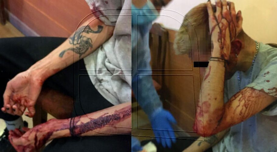 Movilh denunció violentó ataque a jóvenes en restaurante de Providencia